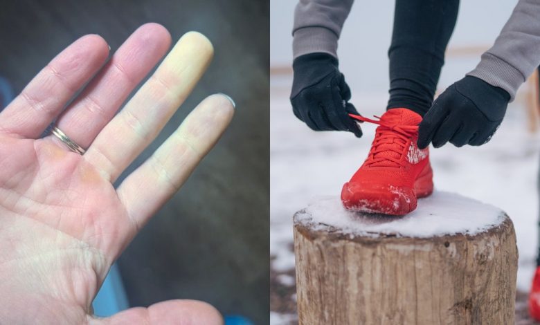 how-to-exercise-outside-with-raynaud’s-syndrome-without-freezing-your-fingers-off